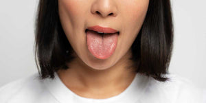Comment soulager une brulure à la langue
